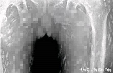 医院|女子市场买的鲜鱼,吃完感觉身体不适,到医院检查后冒了一身汗