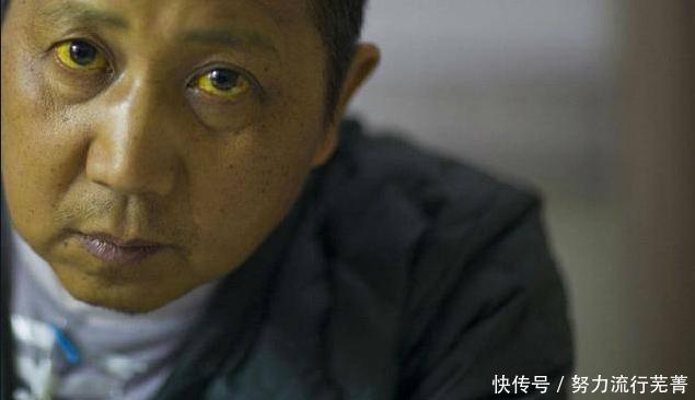 黄曲霉毒素|转告家人这种水果堪称“毁肝王”,早该拉入黑名单,趁早管住嘴