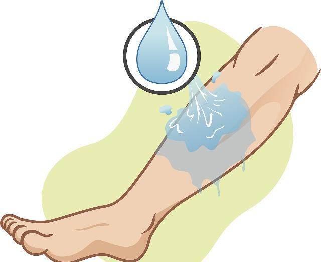  咬伤|怎么办？孩子被宠物咬伤了！