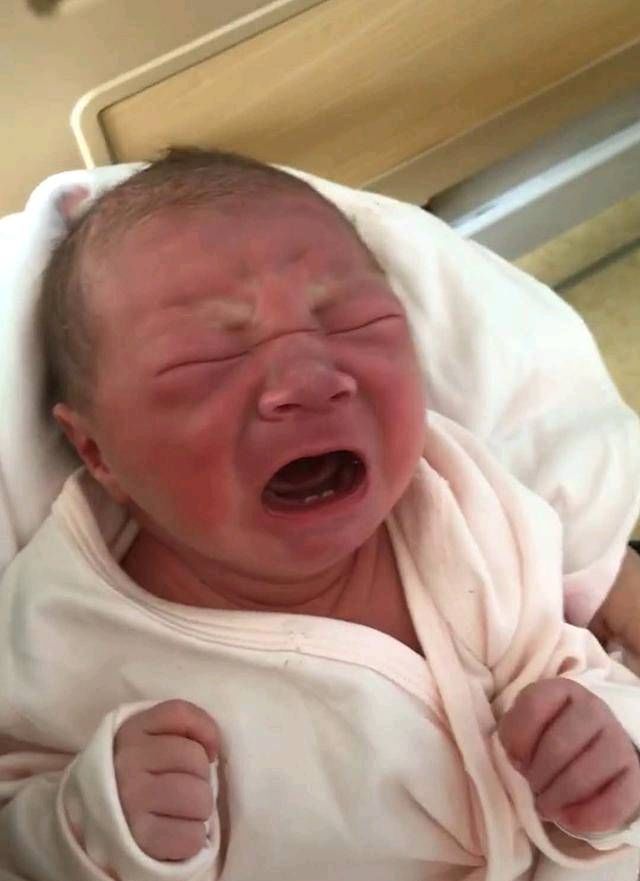  医生|这婴儿生下来有两颗牙母亲很自豪，但医生说你的痛苦才刚刚开始