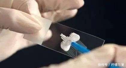 检查|女性若做了这五个检查都没问题,恭喜你,你可能离妇科病很远