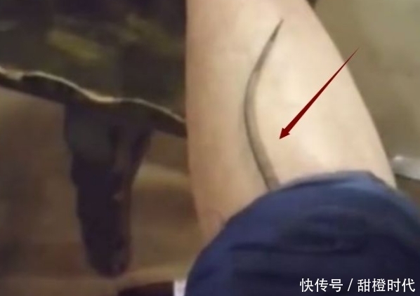 发现|男子请客去饭店吃饭,发现腿上有东西在爬,撸起裤子不淡定了