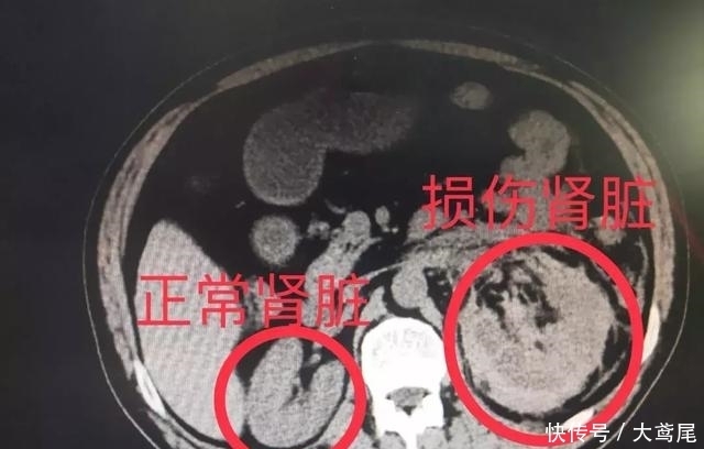  诊室|医生多看一眼，救两条命！非医生曝光，你永远无法看到这幕