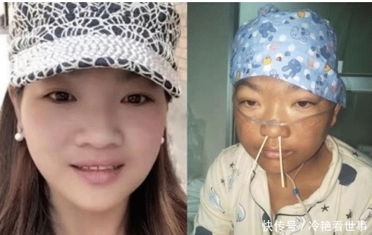 做法|“村花”嫁给穷小伙, 不幸患病“毁容”后对方的做法令人落泪