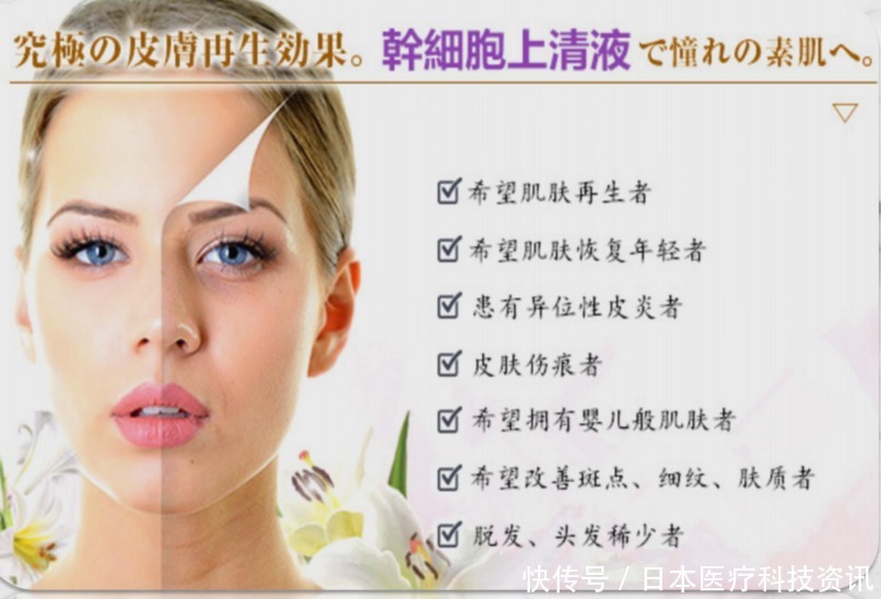 治疗|日本最先端保养品,干细胞上清液!