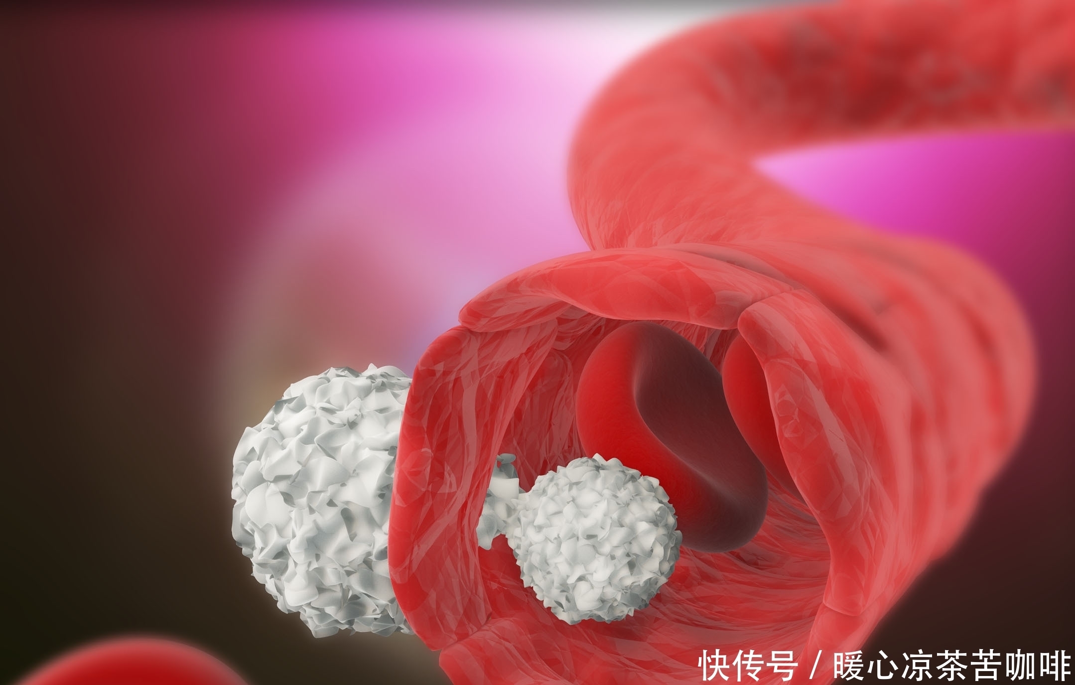 忌口|血脂超标的人，“3黄”尽早忌口，做好2事，保持血管年轻态