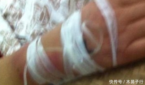 做梦吃猪蹄啃手|一男子做梦吃猪蹄，醒了却赶紧送医院，背后真相让人惊呆了