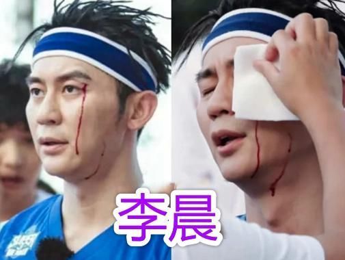 血流|明星参加综艺节目有多危险邓超打石膏、baby骨折,而他血流不止