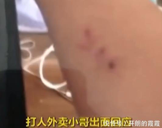  互殴|看看谁才是爹！外卖员被醉酒男碾脚辱骂，气不过与其互殴反赔7万