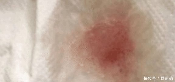 事后|网上相亲需谨慎，女子以为遇良缘半推半就丢了初夜，事后晴天霹雳