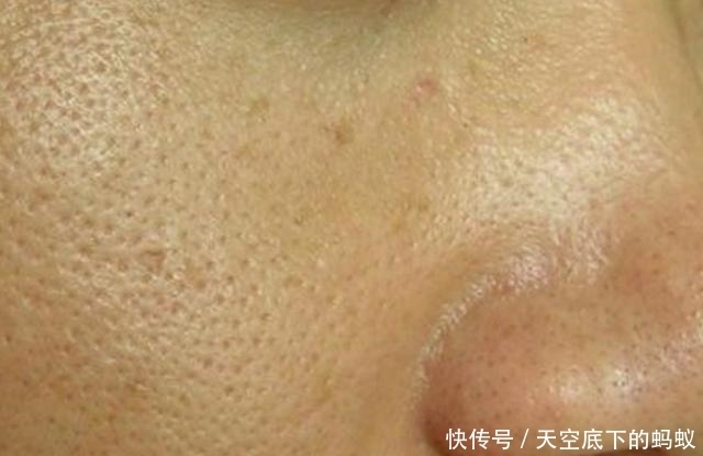 粗大|皮肤暗沉无光、毛孔粗大,老气十足!坚持做好4件事皮肤细腻光滑