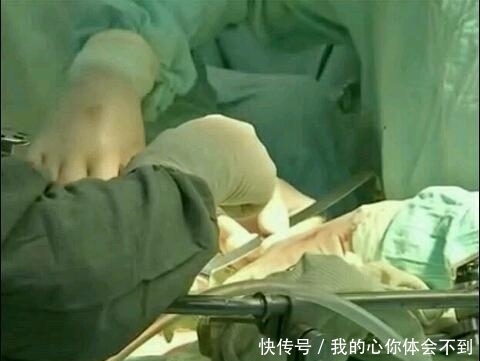 手术|手术后把工作服落入孕妇体内?网友:院方请给一个说法
