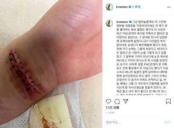 无辜|没有一片雪花是无辜的权珉娥再次自杀送医割腕太多次神经断裂