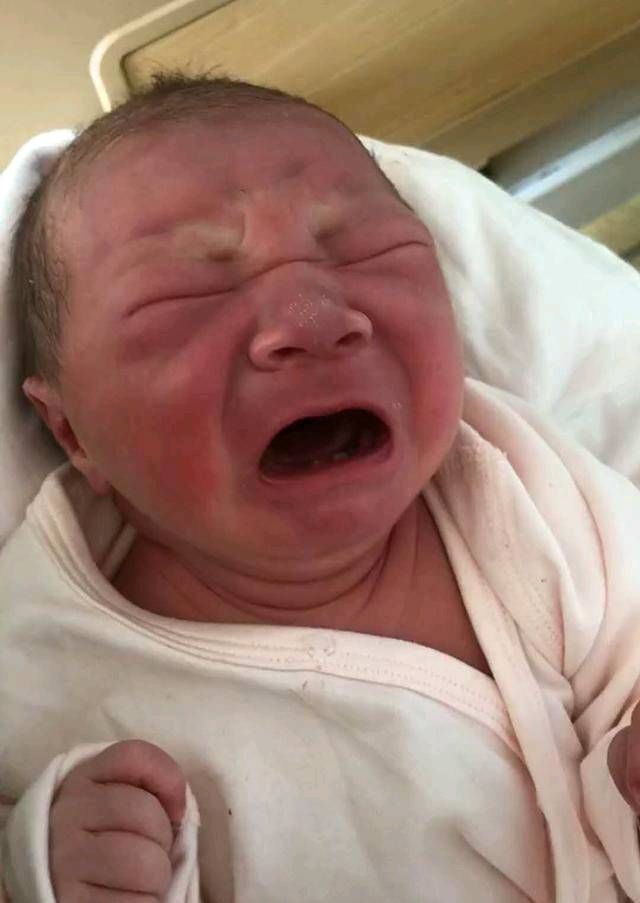  医生|这婴儿生下来有两颗牙母亲很自豪，但医生说你的痛苦才刚刚开始