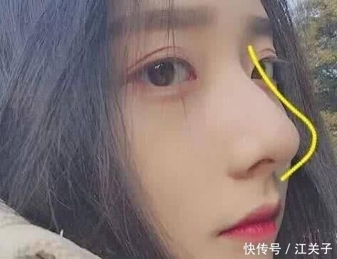 婴儿|鼻子上挤出“白色条状物”？坚持做到这3点，还你光滑“婴儿鼻”！