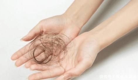 掉头发|掉头发是因压力大?看了袁咏仪的护发秘籍,原来一直都做错了!