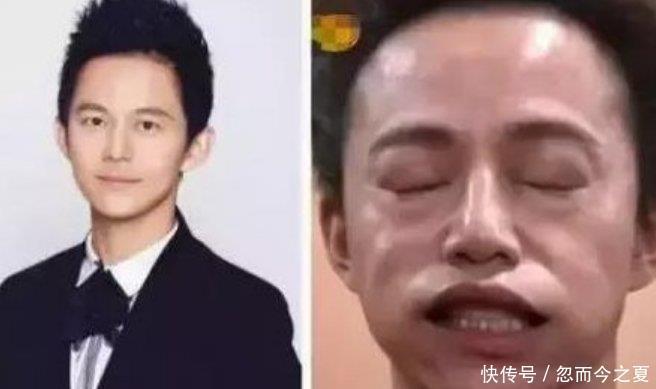  假体|明星接受干冰惩罚，杨颖有没有整容一目了然，图5却被吹出假体