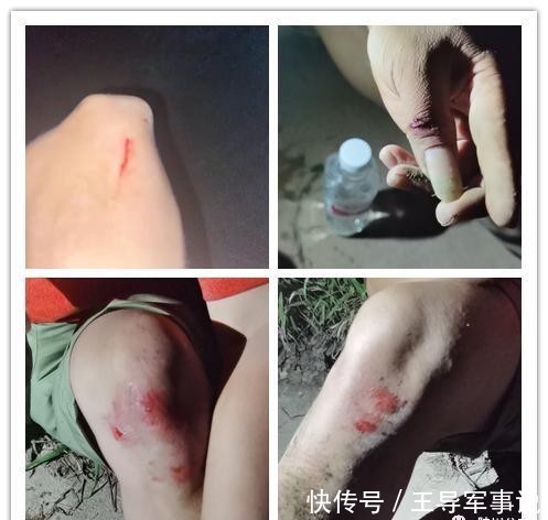 负伤|陆川警方两名辅警抓捕行动负伤永不放弃,成功抓捕贩毒人员