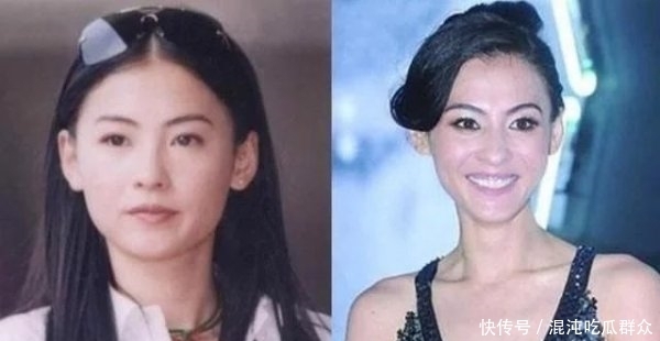 已成|别冲动!为瘦脸舍弃脸颊“肉垫”麻烦多,知名港星已成反面典型