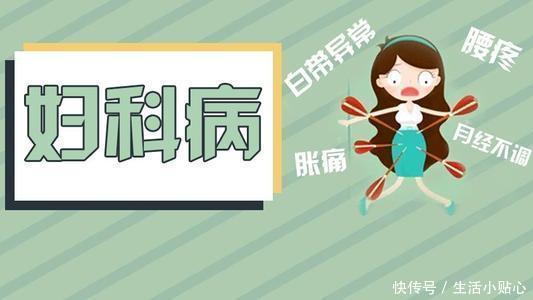 妇科疾病治疗