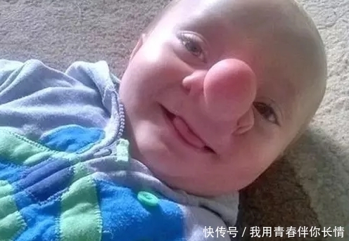 狠心|女子生下大鼻子孩子，男子狠心抛弃，一年以后哭求原谅