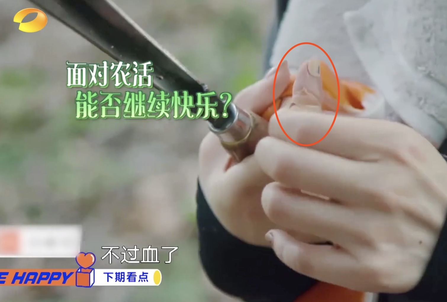 应对|吴昕首次录制《向往的生活》就受伤!应对方式低调,丝毫不娇气