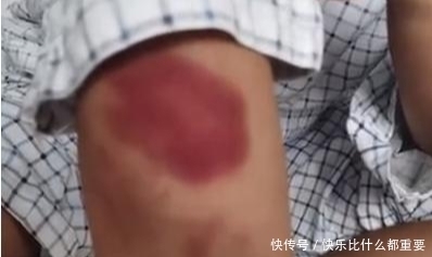 男朋友|一女子自曝遭公职男友殴打3小时，警方已介入，单位：已批评教育