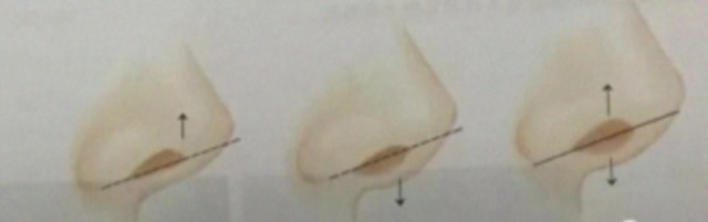  女主|甩了唐嫣老公，从小陶虹整成杨幂，却flop到接二手女主