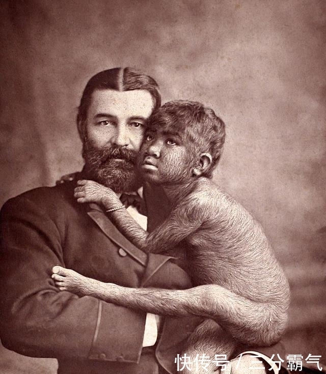 部落里|138年前抓到的“野人女孩”,最终命运如何?死前一句话让人心酸