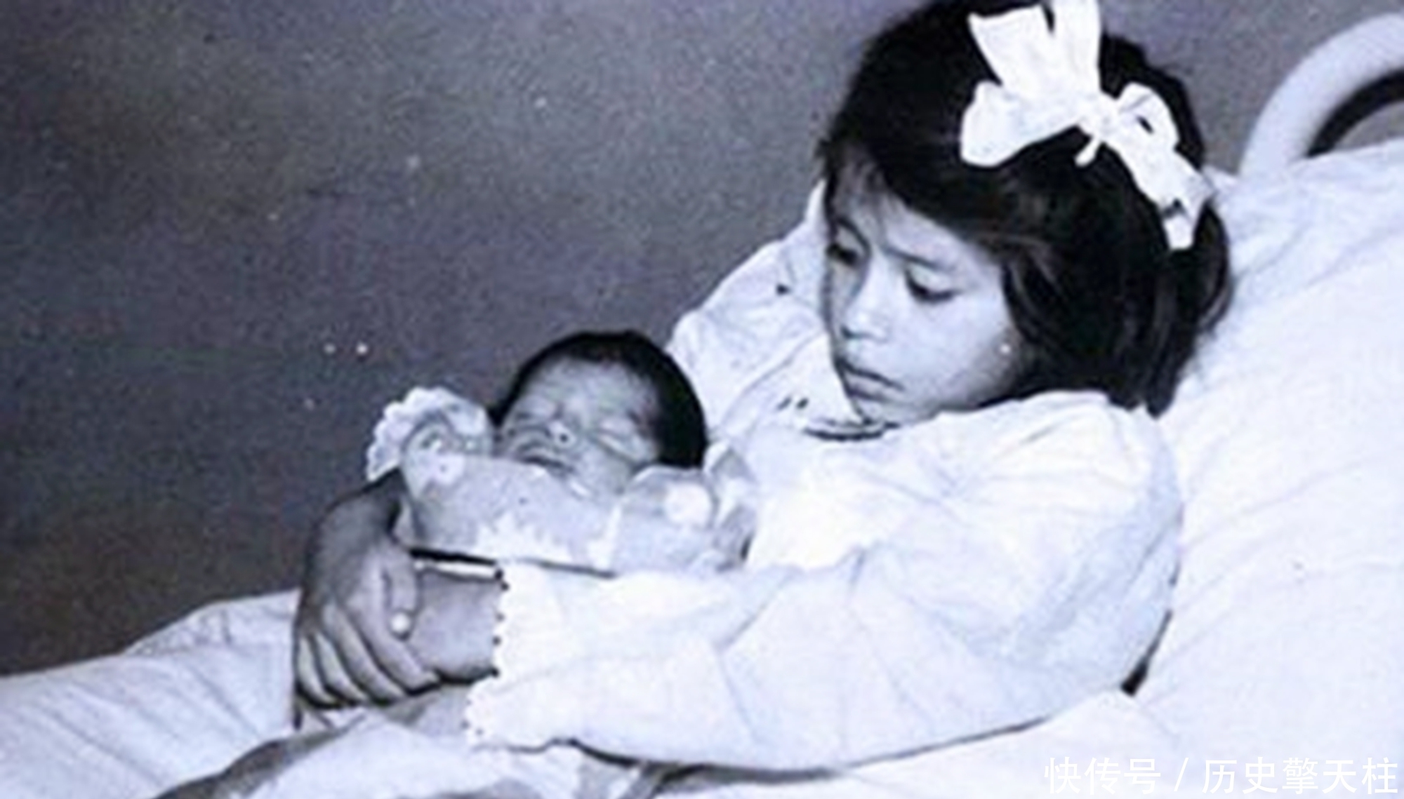 寄生|史上最小产妇非寄生胎,5岁产子打破生育极限,儿子称她“姐姐”