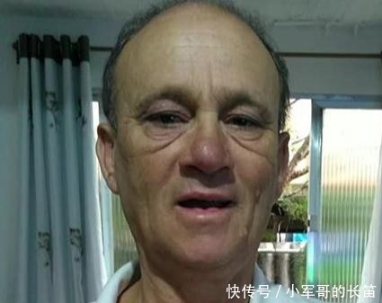 森林|巴西老人为骗取保险，故意烧车，不料烧毁整个森林保护区