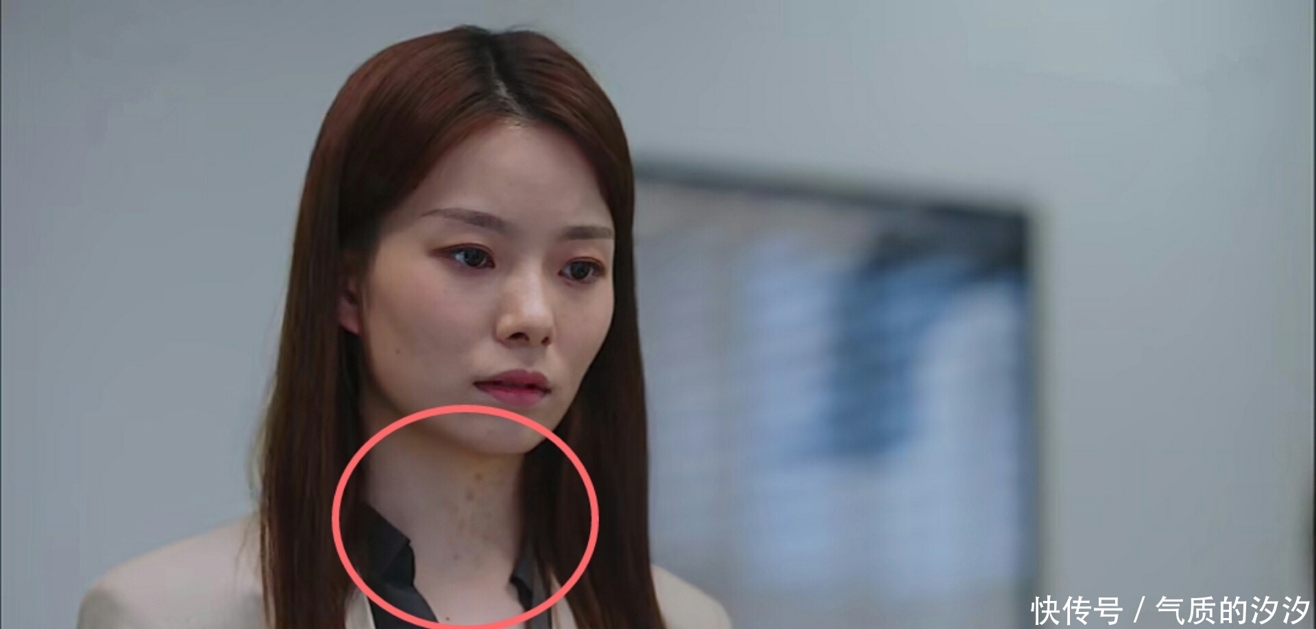 亲爱|《亲爱的自己》:林玲的扮演者陈卓璇,毫不掩饰的胎记是认真的吗