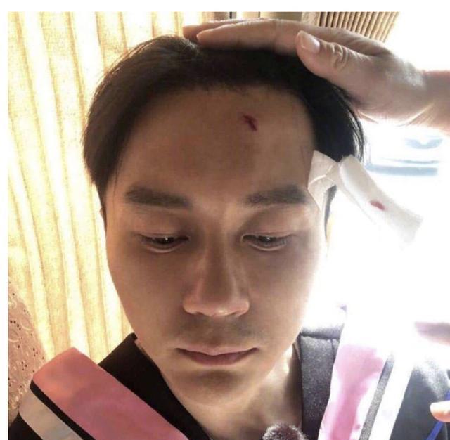 杨洋|明星参加综艺有多危险?杨洋吸毒气留下后遗症,而他却再也没醒来